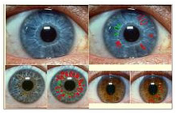 虹膜整體觀念以氣血為傳導